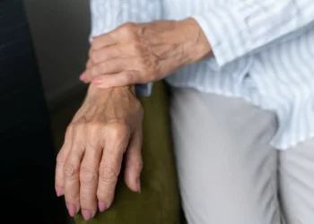 Enfermedad de Parkinson: ¿Por qué la demencia es aparte común y más tardía?